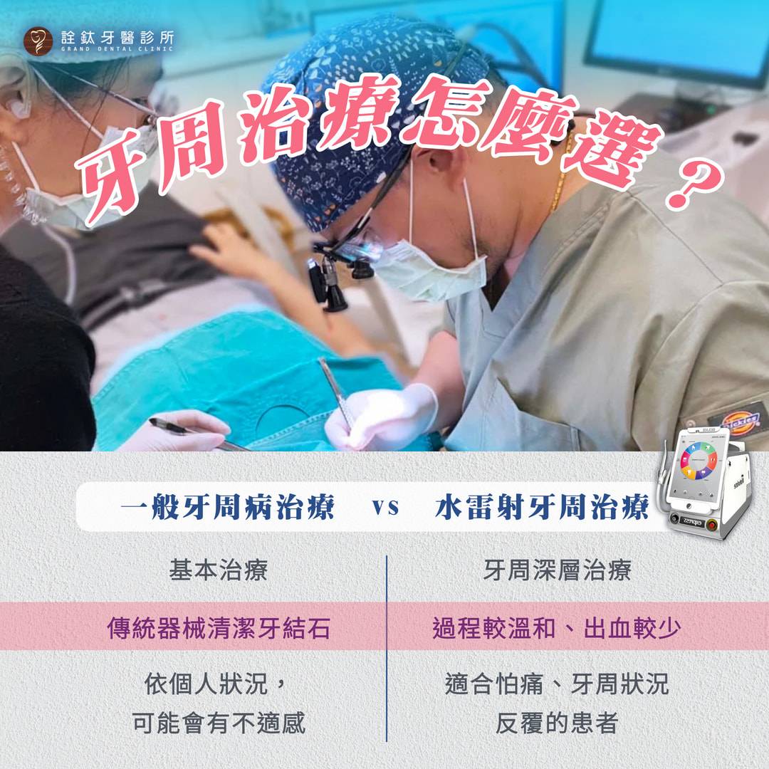 水雷射牙周病治療 水雷射牙周病治療